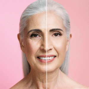 Anti Ageing