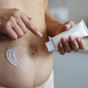 Stretch Marks